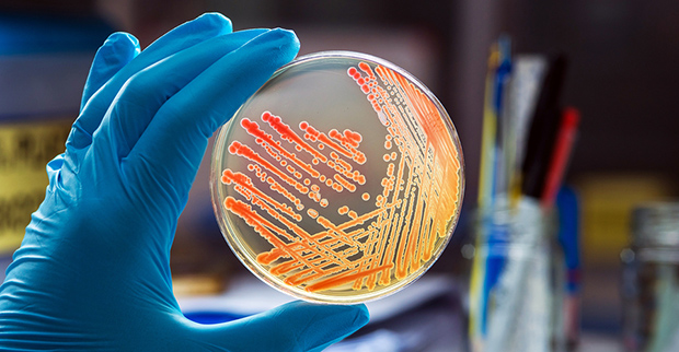 Scientist holding a colony of bacteria in a petri dish