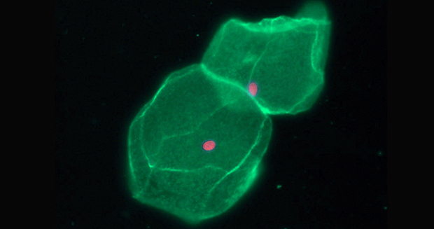 Plasma membrane and nucleas