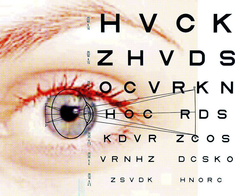 close up of a person's eye as he looks at an eye chart